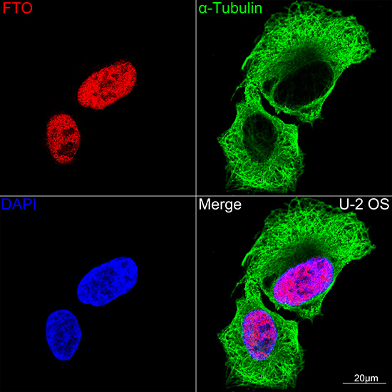 [KO Validated] FTO Rabbit monoclonal antibody