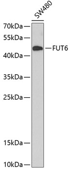 FUT6 Rabbit polyclonal antibody