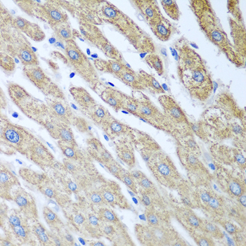 FUT6 Rabbit polyclonal antibody