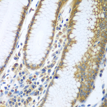 FUT6 Rabbit polyclonal antibody