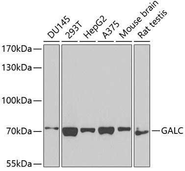 GALC Rabbit polyclonal antibody