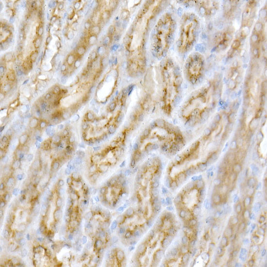 GALC Rabbit polyclonal antibody