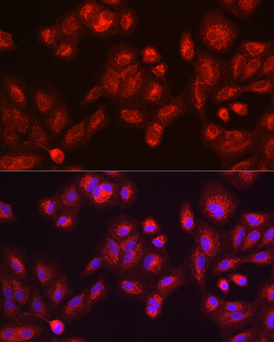 GALC Rabbit polyclonal antibody