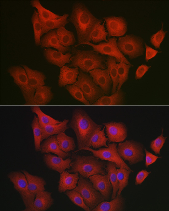GART Rabbit polyclonal antibody