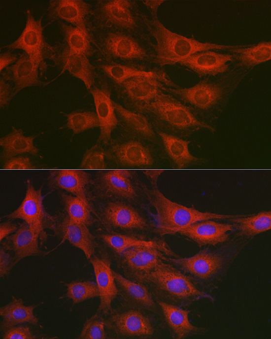 GART Rabbit polyclonal antibody