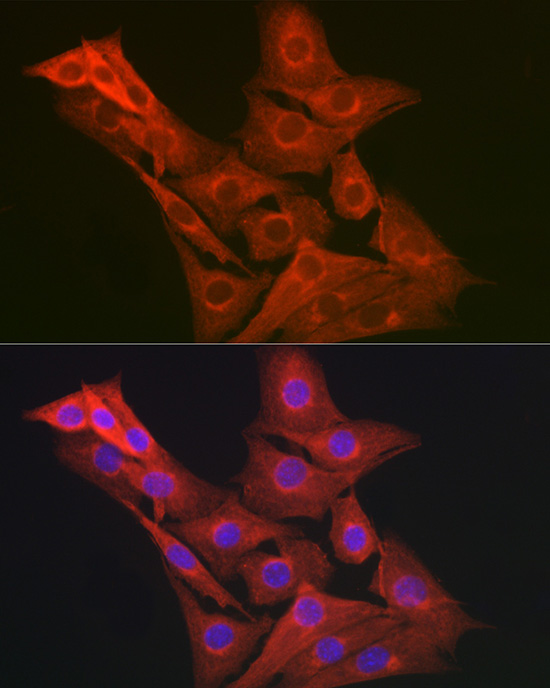 GART Rabbit polyclonal antibody