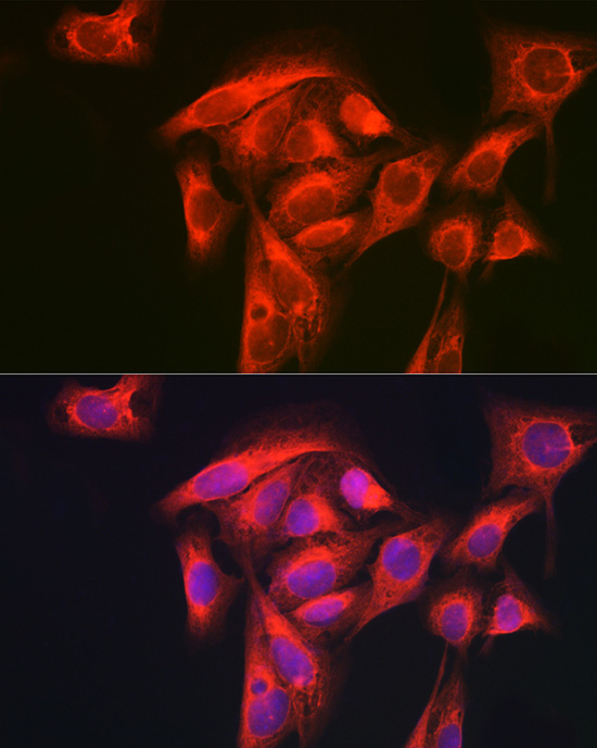 GART Rabbit polyclonal antibody