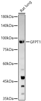 GFPT1 Rabbit polyclonal antibody