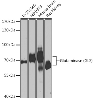 Glutaminase (GLS) Rabbit polyclonal antibody
