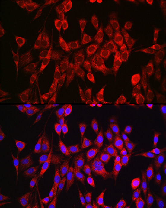 Glutaminase (GLS) Rabbit polyclonal antibody