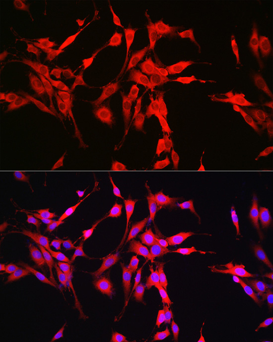 Glutaminase (GLS) Rabbit polyclonal antibody