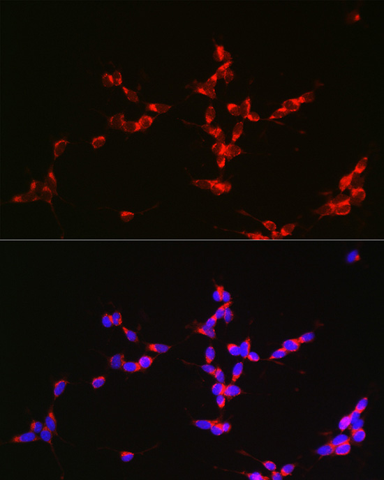 Glutaminase (GLS) Rabbit polyclonal antibody