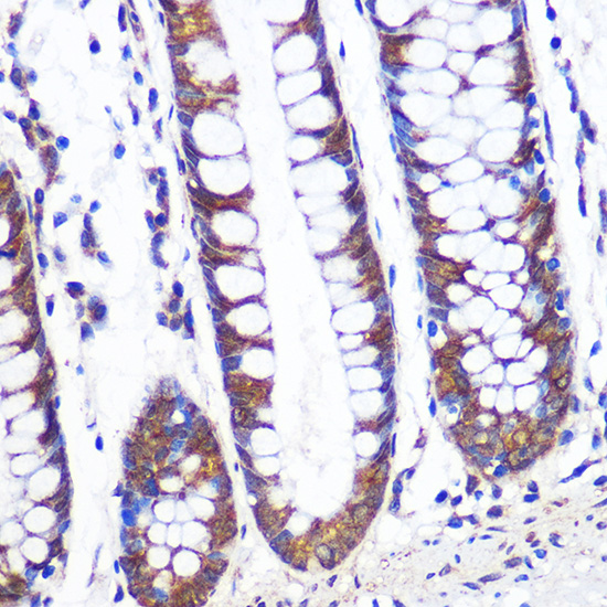 TCP1 alpha Rabbit monoclonal antibody