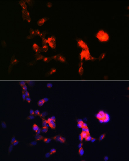 DKK3 Rabbit monoclonal antibody