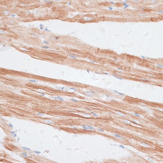 GRK5 Rabbit polyclonal antibody