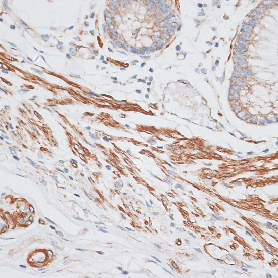 GRK5 Rabbit polyclonal antibody