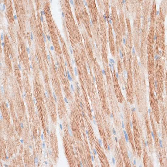 GRK5 Rabbit polyclonal antibody
