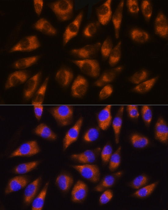 GRK5 Rabbit polyclonal antibody