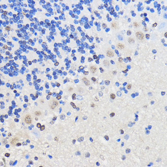 hnRNP U Rabbit polyclonal antibody