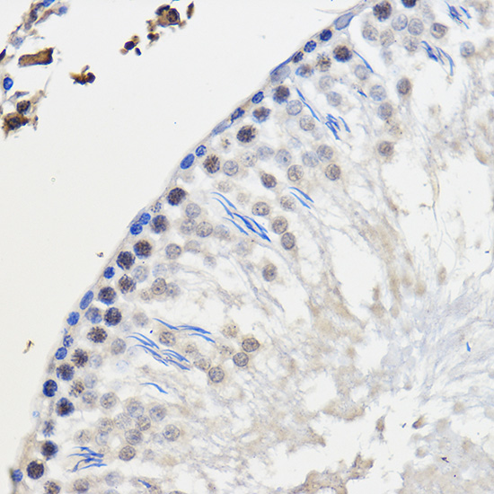 hnRNP U Rabbit polyclonal antibody
