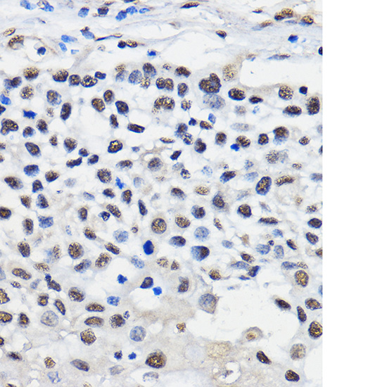 hnRNP U Rabbit polyclonal antibody