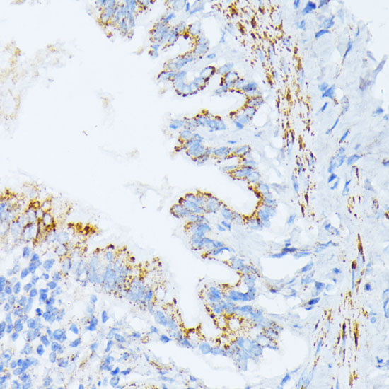 IL3RA Rabbit polyclonal antibody