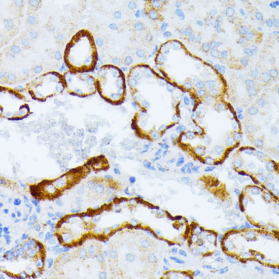 IL3RA Rabbit polyclonal antibody