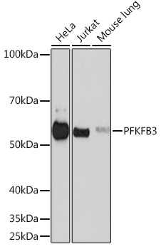 PFKFB3 Rabbit monoclonal antibody