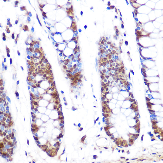 PFKFB3 Rabbit monoclonal antibody