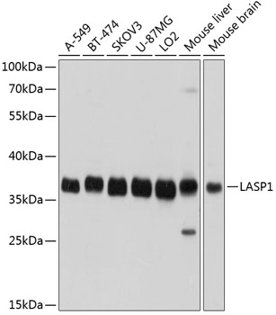 LASP1 Rabbit polyclonal antibody