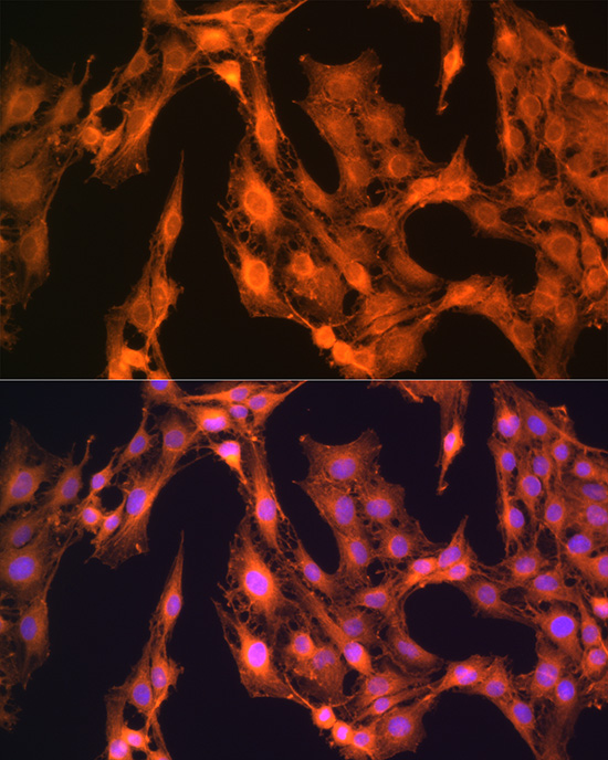 LASP1 Rabbit polyclonal antibody