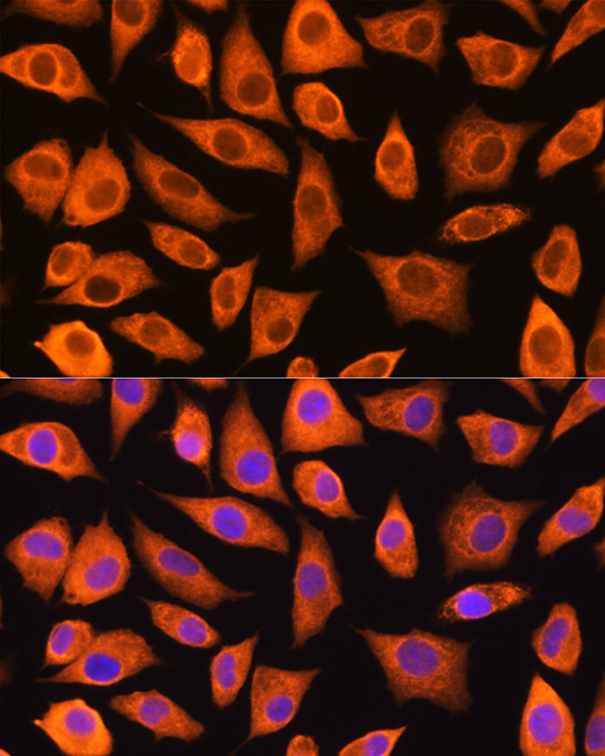 LASP1 Rabbit polyclonal antibody
