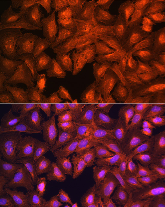 LASP1 Rabbit polyclonal antibody