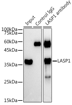 LASP1 Rabbit polyclonal antibody