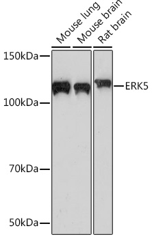 ERK5 Rabbit monoclonal antibody