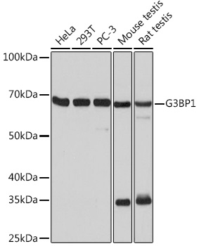 G3BP1 Rabbit monoclonal antibody