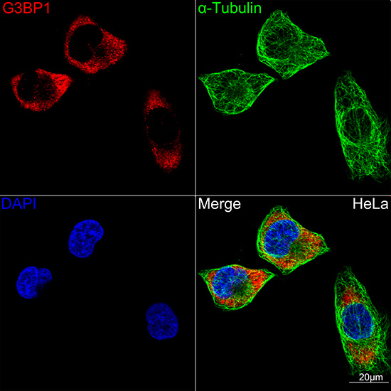 G3BP1 Rabbit monoclonal antibody