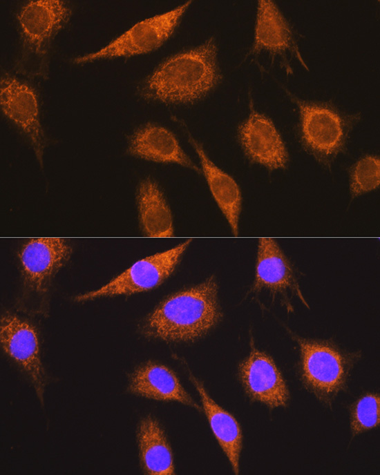 MUT Rabbit polyclonal antibody