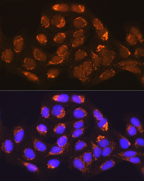 MUT Rabbit polyclonal antibody