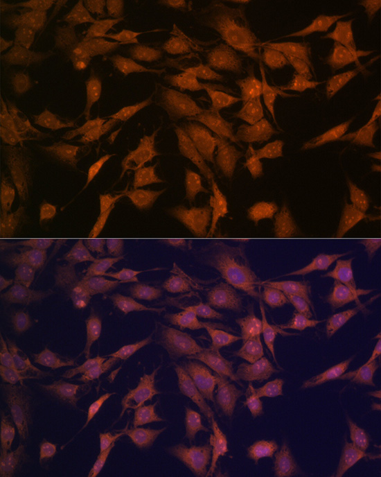 CENPC Rabbit monoclonal antibody