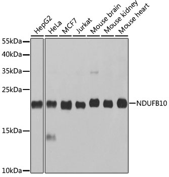 NDUFB10 Rabbit polyclonal antibody