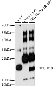 NDUFB10 Rabbit polyclonal antibody