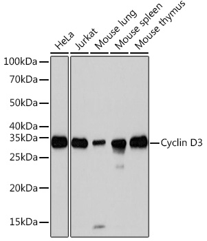 Cyclin D3 Rabbit monoclonal antibody