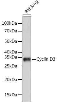 Cyclin D3 Rabbit monoclonal antibody