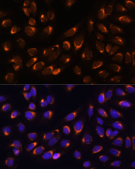 [KO Validated] NUCB1 Rabbit polyclonal antibody