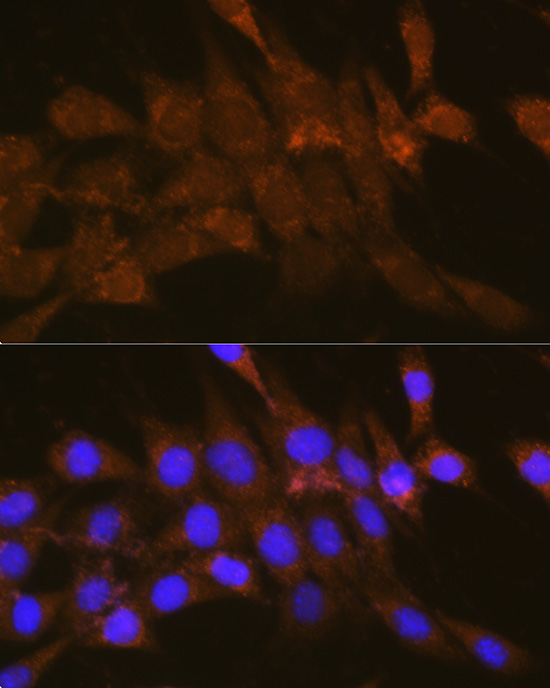 OSBP Rabbit polyclonal antibody