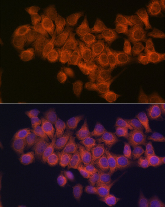 NDUFAF1 Rabbit monoclonal antibody