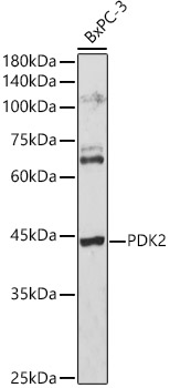 PDK2 Rabbit polyclonal antibody