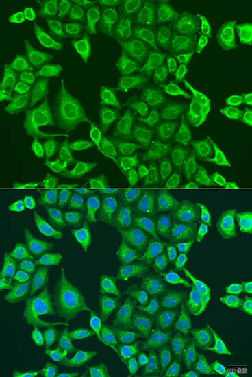 PDK2 Rabbit polyclonal antibody