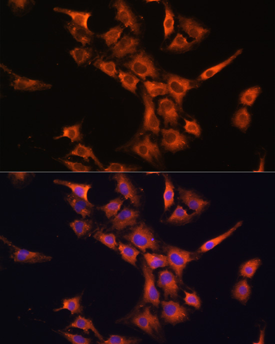 PFDN5 Rabbit polyclonal antibody
